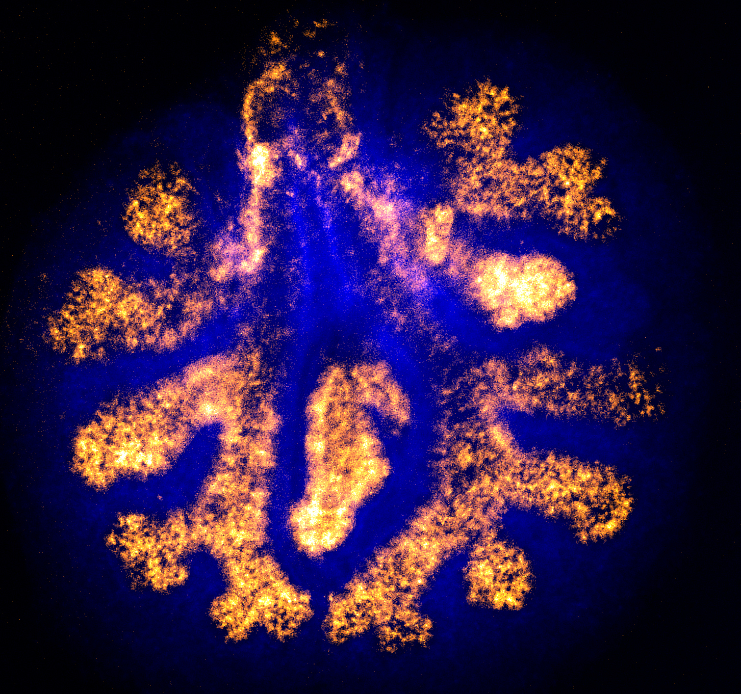 Fluorescence micrograph of lung tissue